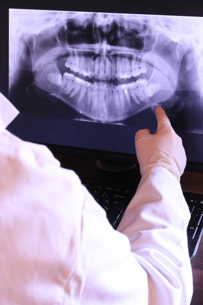 Best Emergency Root Canal Treatment in Hollandale, MS