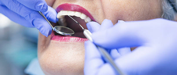 Best Emergency Tooth Extraction in Hollandale, MS